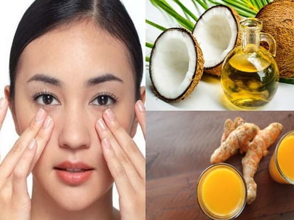 Mẹo chữa quầng thâm mắt với dầu dừa 